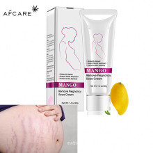 Collagen Remove Stretch Marks Cream Anti Wrinkle Exfoliating Maternity Skin Repair Remove Pregnancy Scars Treatment Body Skin
